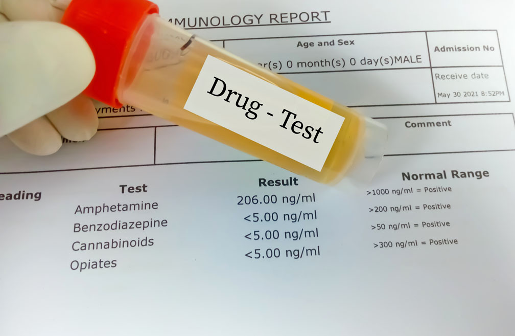 FMCSA denies Trucking Alliance's request to add hair testing for drugs